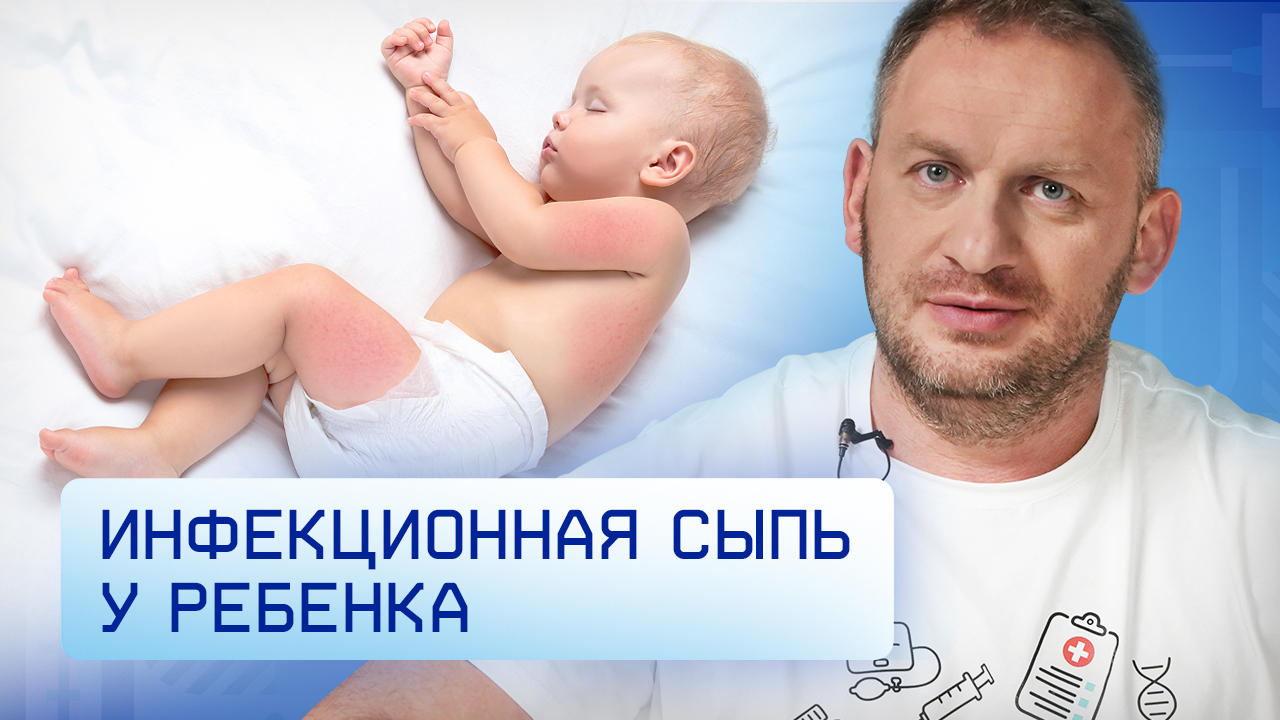 Инфекционные сыпи у детей