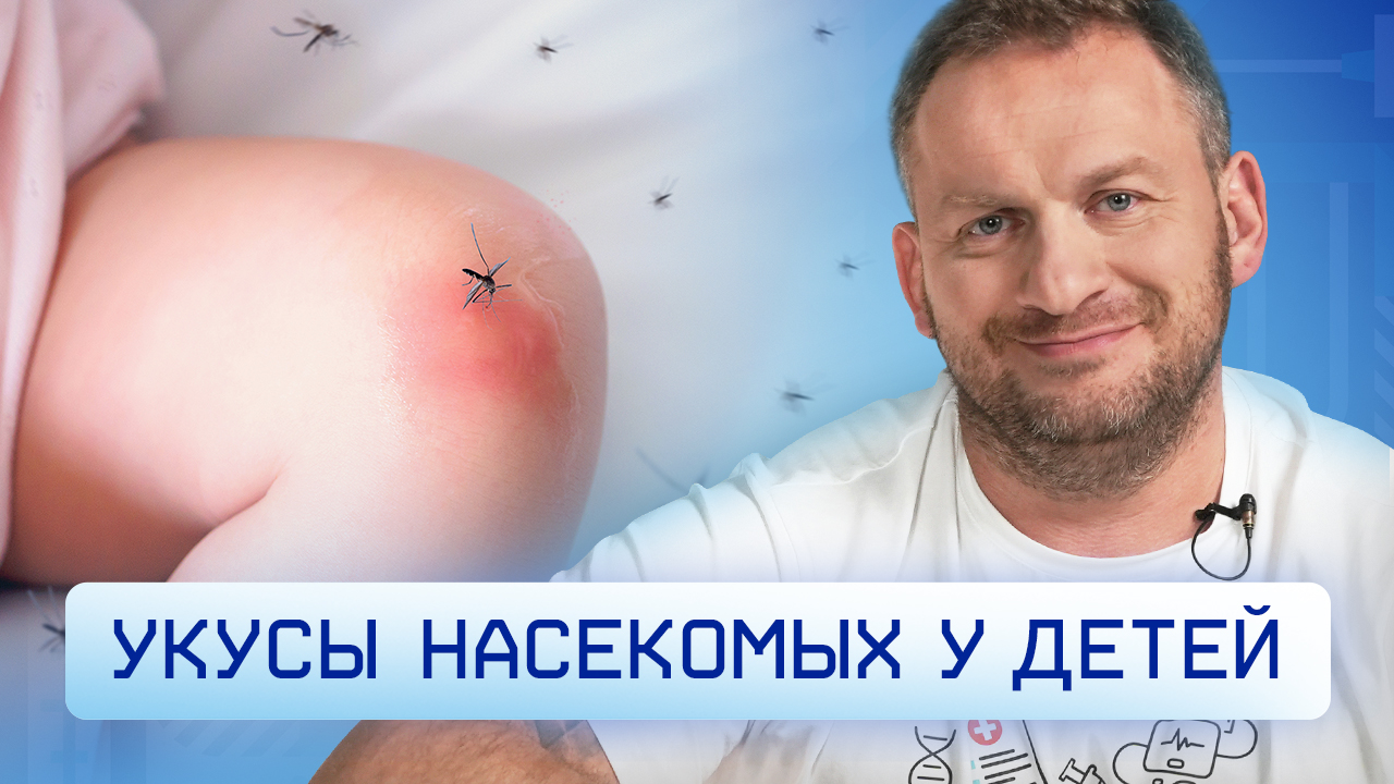 Укусы насекомых