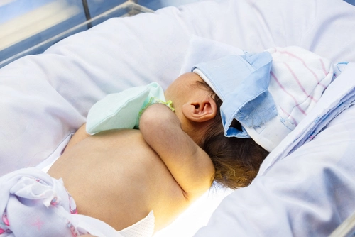 Физиологическая желтуха новорожденных и гемолитическая. Разбираемся в отличиях. Image #1